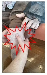 膝蓋骨周辺に痛みあり。