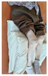 枕3枚にて臥床する。
