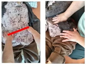 個別前では、骨盤に左右差を確認した。