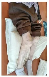 枕2枚にて臥床できる。